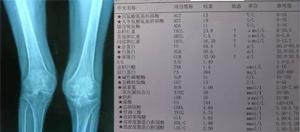 成都风湿医院患者治疗前膝关节CT检查和检查化验单.jpg