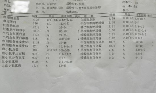 成都风湿医院患者入院检查化验单.jpg