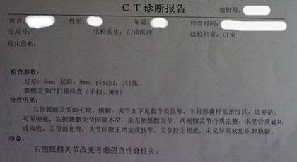 成都风湿医院患者CT检查诊断报告.jpg