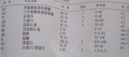 痛风病可能会导致寿命缩短?请关注11月7日晚CDTV3《热线188》 痛风病可能会导致寿命缩短?请关注11月7日晚CDTV3《热线188》