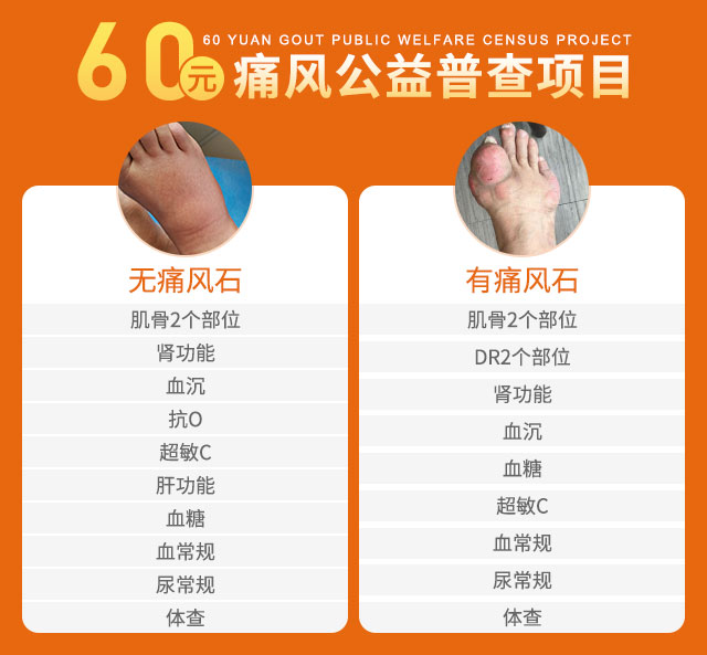 世界睡眠日丨关注痛风引发的睡眠障碍问题暨名医工作室大型会诊 世界睡眠日丨关注痛风引发的睡眠障碍问题暨名医工作室大型会诊
