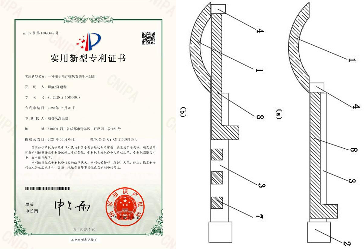 发明人陈建春主任、谭巍主任等:《一种用于治疗痛风石的手术刮匙》 发明人陈建春主任、谭巍主任等:《一种用于治疗痛风石的手术刮匙》